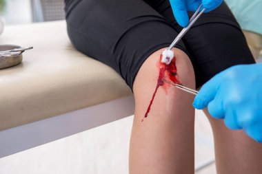 Erkek doktoru ziyaret eden bacağı yaralı bir kadın.