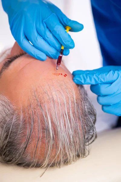 Old man visiting young male doctor in hair transplantation conce — Stock Photo, Image