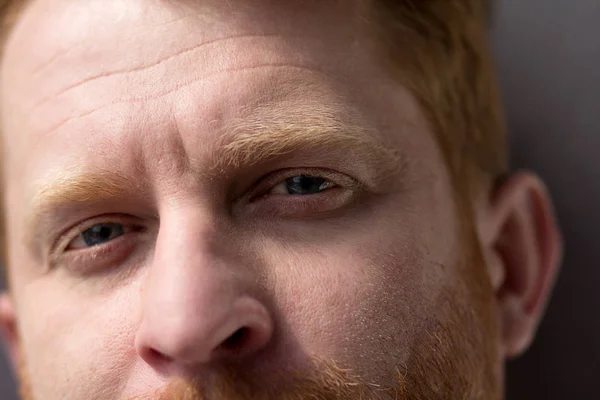 Close up of man with ginger hair. — Stock Photo, Image