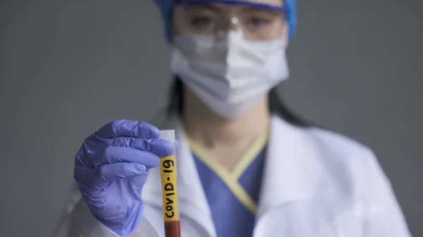 Tubo de teste de sangue com inscrição covid-19 em médicos mão em primeiro plano. Foco seletivo no tubo de ensaio com etiqueta amarela. Close up tiro de mulher trabalhadora de laboratório médico — Fotografia de Stock