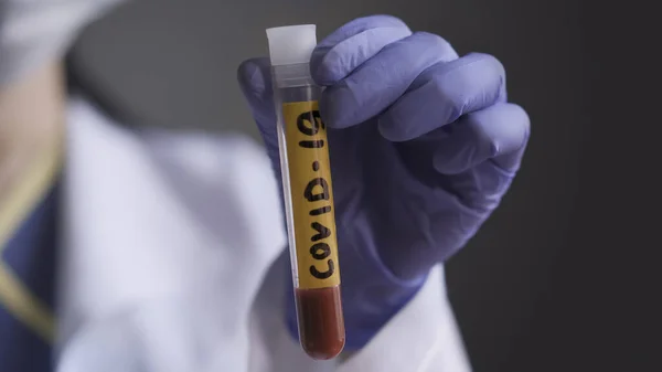 คนงานห้องทดลองที่มีหลอดทดสอบเลือด ของการทดสอบโควิด-19 สุดยอดภาพใกล้ชิดของมือผู้หญิงถือท่อทดสอบที่มีป้าย covid-19 บนสติ๊กเกอร์สีเหลือง — ภาพถ่ายสต็อก