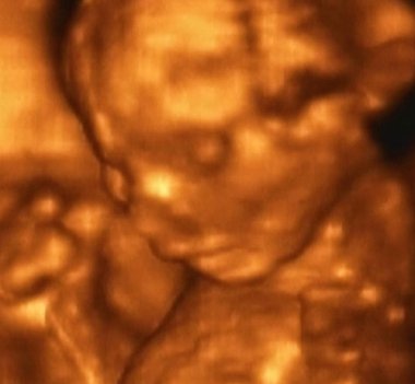 4. Ay Fetüsü 'nün 3D Ultrasonografi Analizi, İtalyan Laboratuvarları