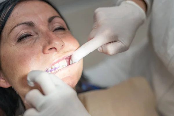 Vrouw 40S Stoel Van Tandarts Ondergaan Tandheelkundige Controle Met Opdruk — Stockfoto