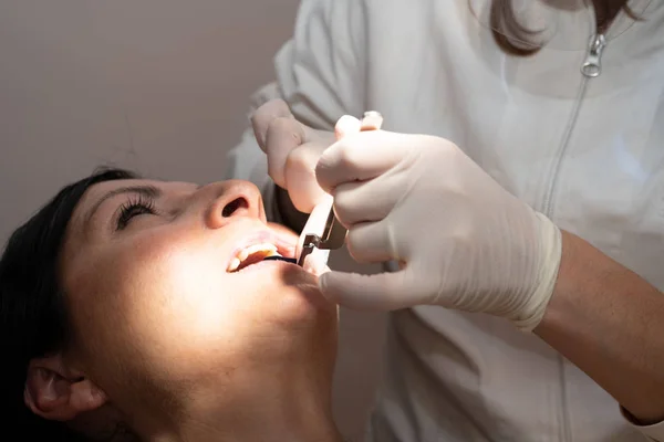 40多岁的妇女微笑 而牙医在白色乳胶手套检查情况下她的牙齿 — 图库照片