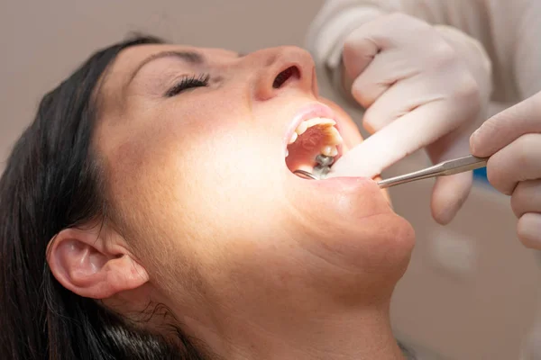 Woman Undergoing Dental Check Dentist Room — Stock Photo, Image