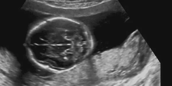 Ultraschalluntersuchung Eines Fetus Monat Italien — Stockfoto