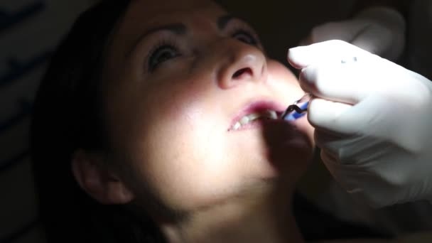 Donna Con Bocca Aperta Dal Dentista Medico Mettendo Pasta Sui — Video Stock