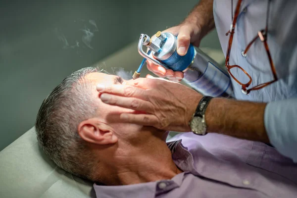 Yerel Kriyoterapi Alma 50S Adamın Yüzü Yakın Çekim Buharlaşmış Azot — Stok fotoğraf