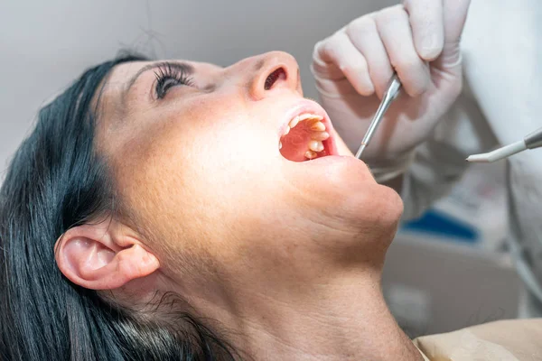 Mulher Bonita Dentista Para Implantologia Dentária — Fotografia de Stock