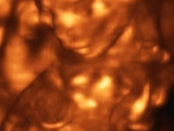 Ultraschalluntersuchung Eines Fetus Monat Italien — Stockfoto