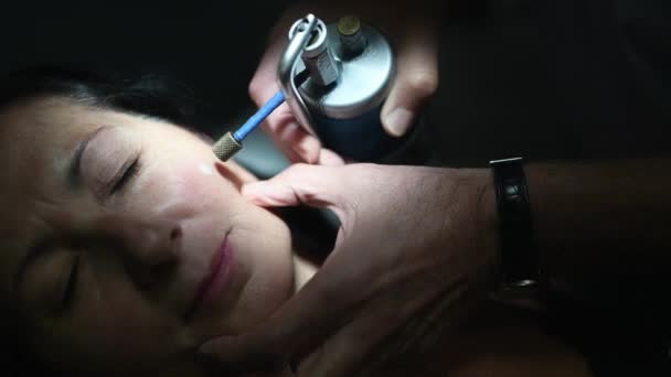 Közeli Felvétel Krioterápiát Készítő Felnőtt Nőről — Stock videók