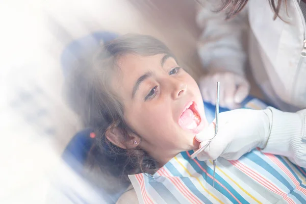 开放口腔进行牙科检查的年轻女孩 — 图库照片
