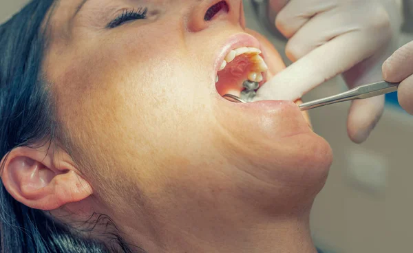 Mulher Cheque Dentário Sala Dentista — Fotografia de Stock