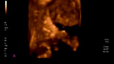 siyah arka planda Echography yakın çekimler