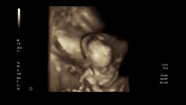 Close Beelden Van Echography Zwarte Achtergrond — Stockvideo