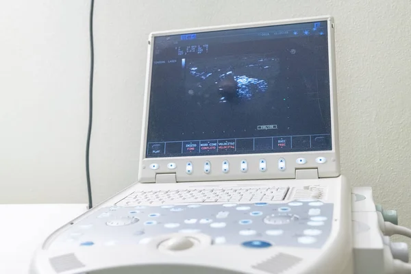 Machine à ultrasons pour tyroïde — Photo