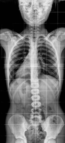 X-ray lumbo-sacrale wervelkolom en hoofd — Stockfoto