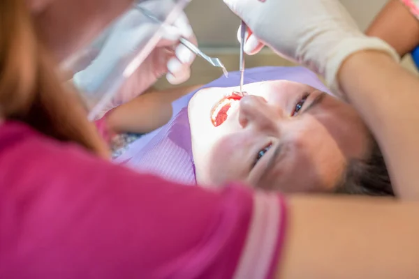 Giovane ragazza visitata dal dentista, primo piano della pulizia dentale — Foto Stock