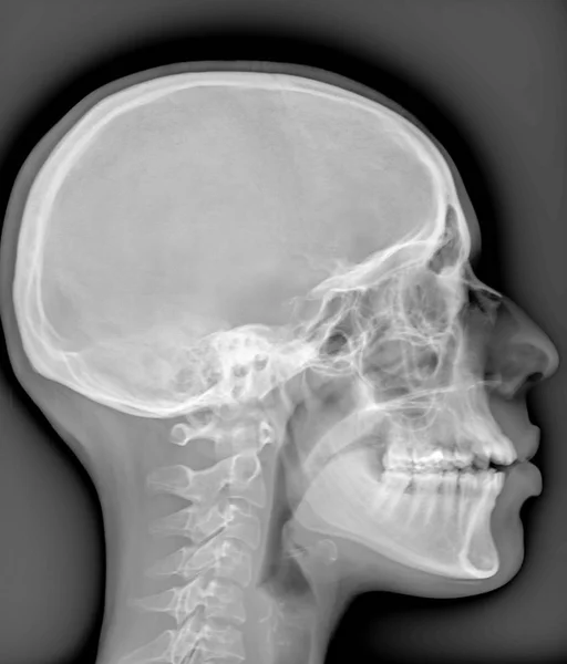 Diagnostische hoofd X-ray film van een patiënt — Stockfoto