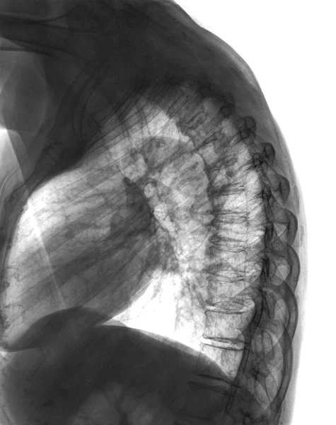 X-ray scan of human spine. Medical examination result — Stock Image X-ray scan of human spine. Medical examination result Royalty Free Stock Images