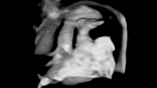 Motie van 4D echografie Echografie van baby un moeders baarmoeder. Levensconcept, wetenschappelijke ontdekking — Stockvideo