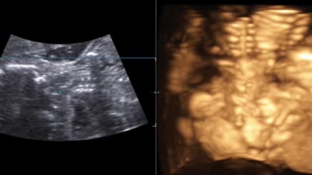 Bewegung des 4D-Ultraschalls Echographie des Babys im Mutterleib. Lebenskonzept, wissenschaftliche Entdeckung — Stockvideo