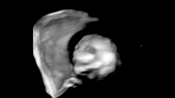 非母胎婴儿4D超声回波成像的运动。生命概念、科学发现 — 图库视频影像
