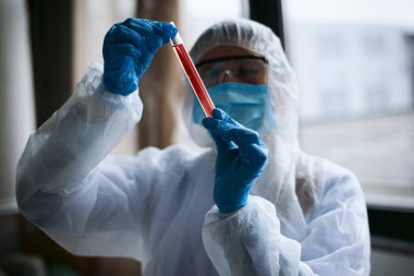 Tıp bilimi laboratuvarı. Virüs ve bakteri araştırması kavramı