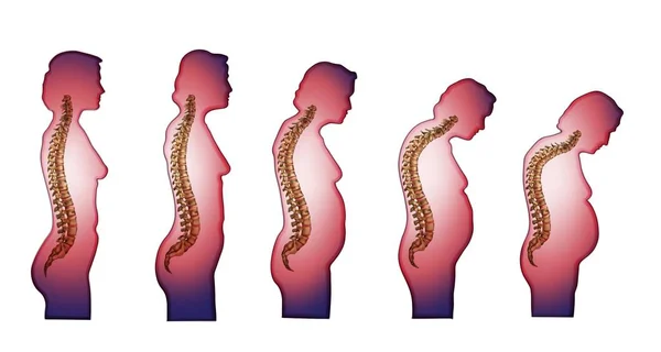 Skeleton Spine Changer Colonne Vertébrale Avec Âge — Image vectorielle