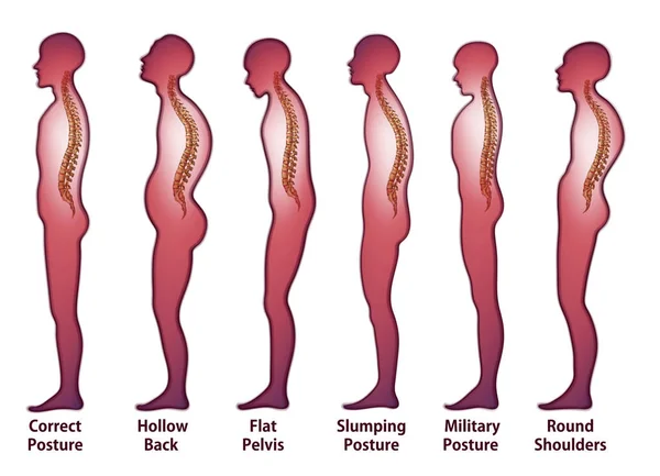 Colonne vertébrale squelettique (posture ) — Image vectorielle