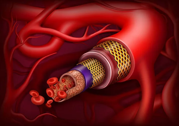 Estructura Arteria Ilustración Vectorial Concepto Médico — Vector de stock