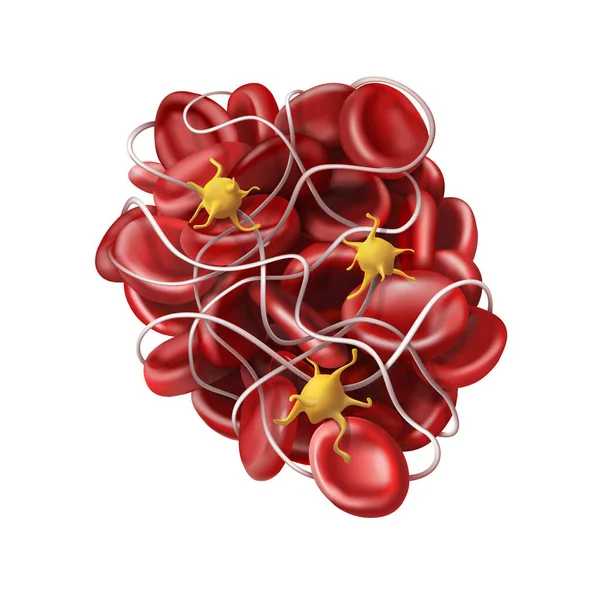 Medicina Coagulo Sangue Trombo Coagulazione Illustrazione Vettoriale — Vettoriale Stock
