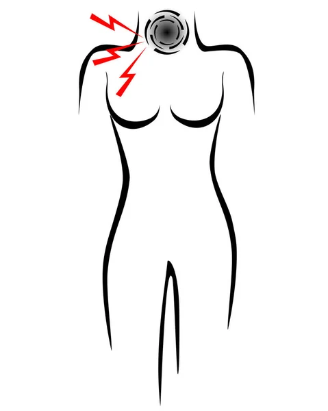 Cuerpo Femenino Estilizado Con Dolor Garganta — Vector de stock