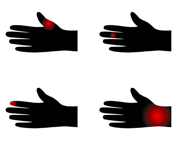 Ανθρώπινα Χέρια Σημεία Πόνου Στο Λευκό — Διανυσματικό Αρχείο