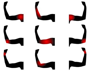 Acı noktaları olan insan kolları