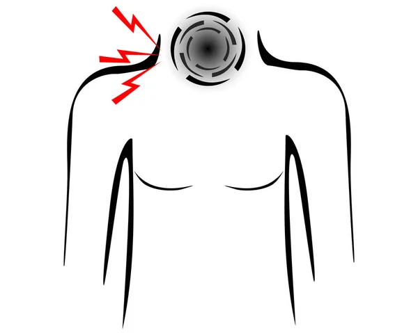 Стилизованное Мужское Тело Болью Горле — стоковый вектор