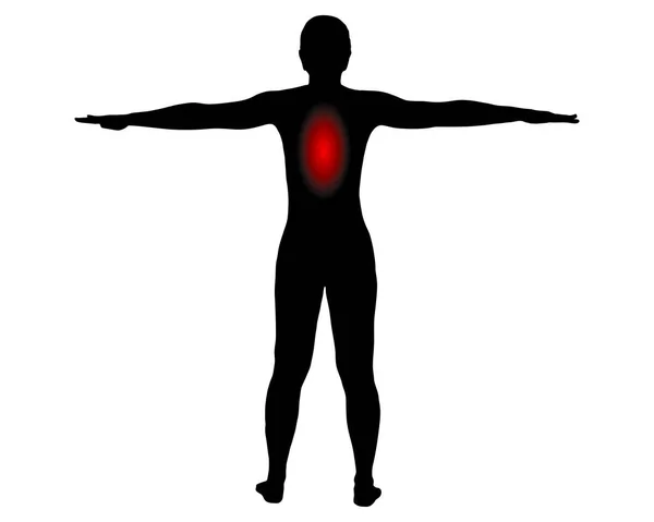 Rückenansicht Einer Frau Mit Schmerzsymbol Rücken — Stockvektor