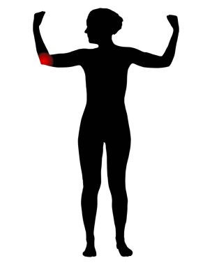 Dirseğinde ağrı olan bir kadının önü.