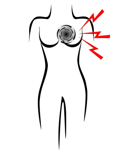 Стилизованное Женское Тело Символом Сердечного Приступа — стоковый вектор