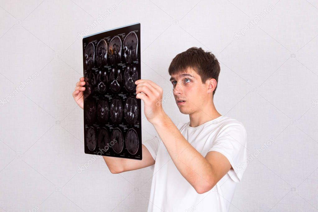 Worried Young Man hold X-Ray Scan on the White Wall Background