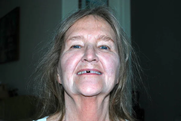 Volwassen Vrouwelijke Blond Senior Schoonheid Expressies Met Een Ontbrekende Tandheelkundige — Stockfoto
