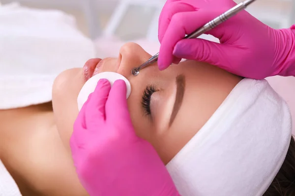 Professional cleansing of acne in a beauty salon. — Stock Photo, Image