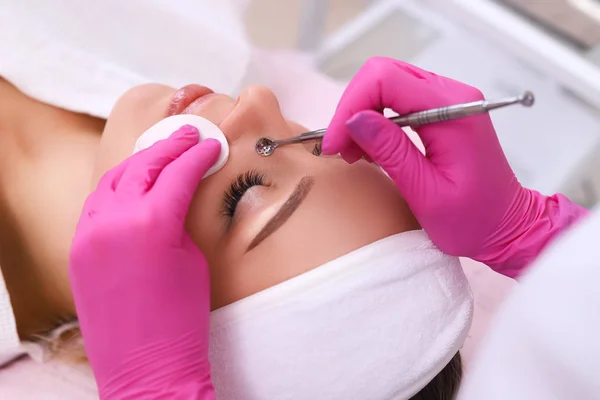 Professionele reiniging van acne in een schoonheidssalon. — Stockfoto