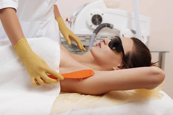 Having underarm laser hair removal epilation