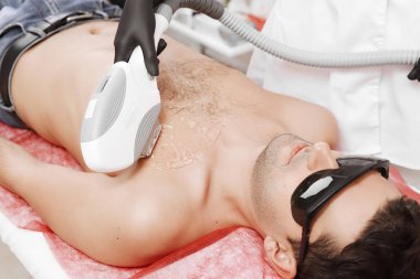 Spa genç erkeklerde lazer epilasyon veren terapist