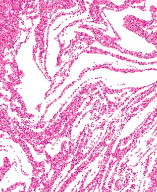 Pembe glitter doku dalgalı arka plan. Konfeti renk parıldıyor. Parlak kutlama vektör çizim.