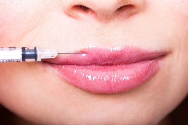 Closeup shot of female lips and syringe — Stock Photo, Image