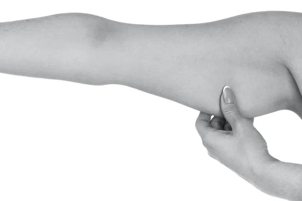 Mulher Segurando Mão Com Excesso Gordura Isolado Fundo Branco — Fotografia de Stock