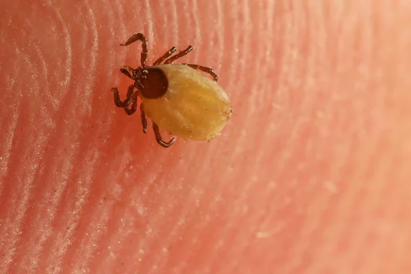 Tick on skin — Stock Photo, Image