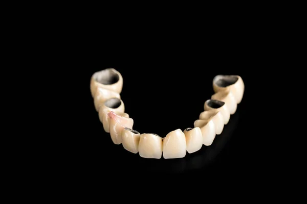 Ponte in ceramica dentale su sfondo nero isolato — Foto Stock